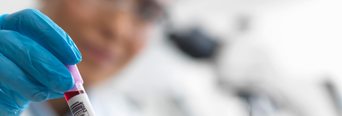 Woman holding test tube of blood in lab setting